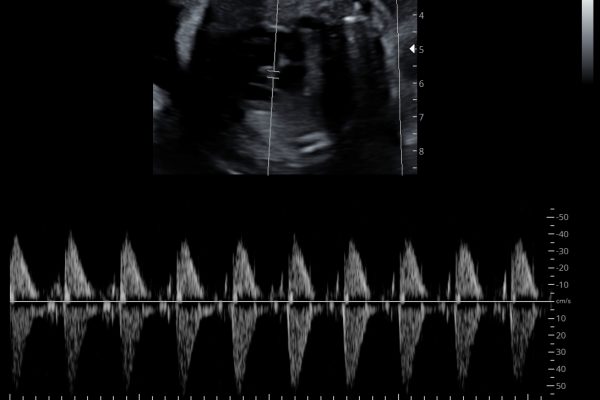 3d-4d-ultrasound7