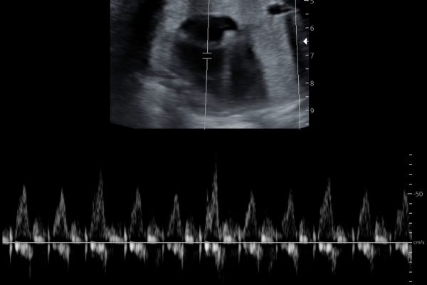 3d-4d-ultrasound9